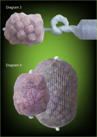 ESP PVA Mesh Kit 32mm 2 ESP PVA Mesh Kit 32mm - Image 2